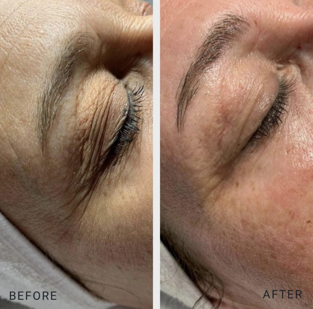 Hydrolifting Signature Facial 20% OFF