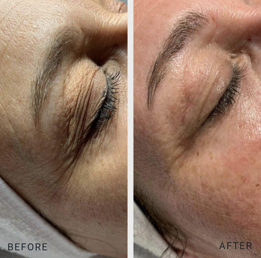Hydrolifting Signature Facial 20% OFF