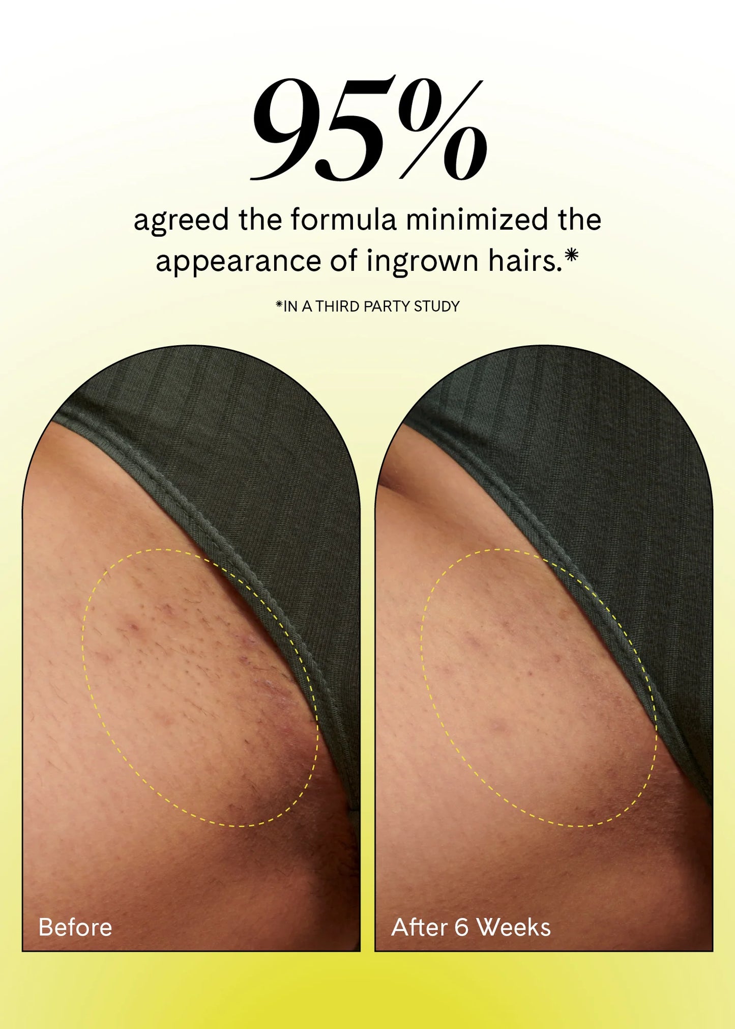 Ingrown Eliminator Serum Rollerball