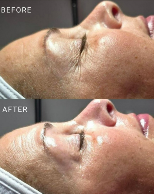 Hydrolifting Signature Facial Series- 20% OFF